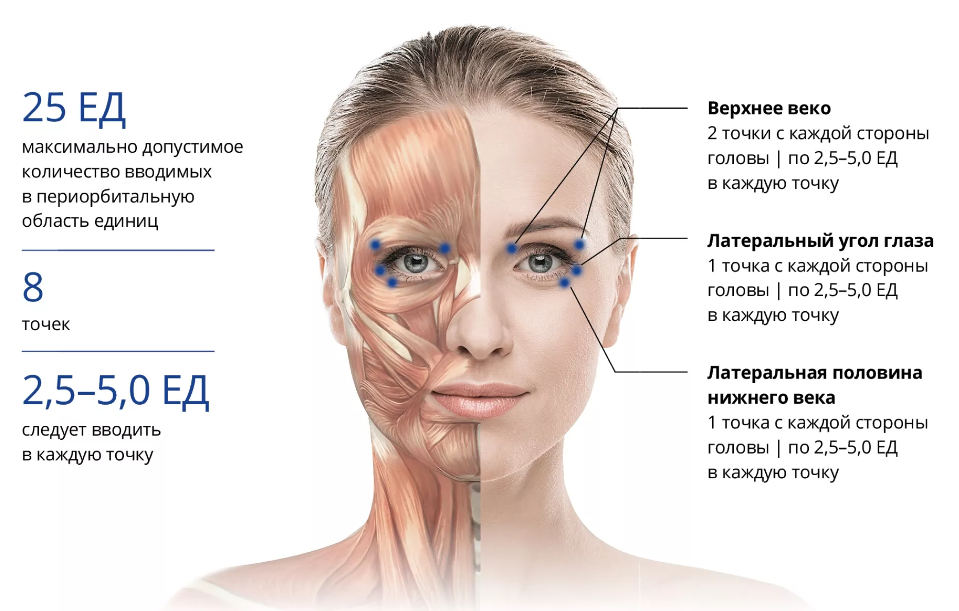 Блефароспазм